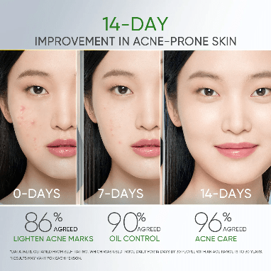 Skintific 3X Acid Anti - Acne Gel Moisturizer 30g. سكينتفيك 3X حمض مضاد لحب الشباب جل مرطب - Princess Cosmetics Qatar