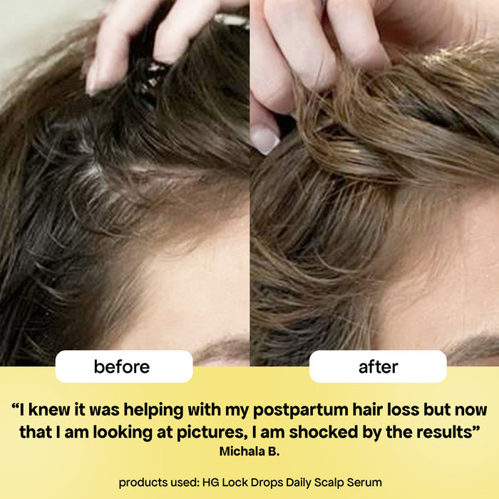 Bondi Boost Hair Growth Lock Drops Anti-Shedding Scalp and Hair Serum