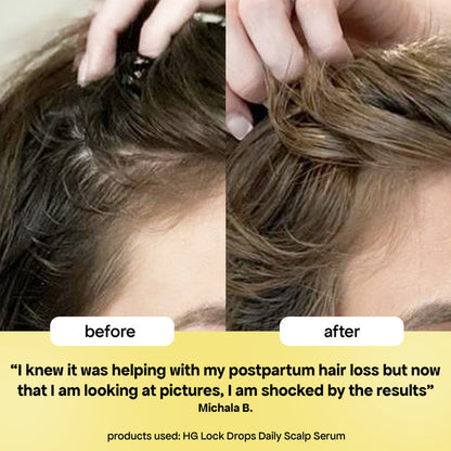 Bondi Boost Hair Growth Lock Drops Anti-Shedding Scalp and Hair Serum
