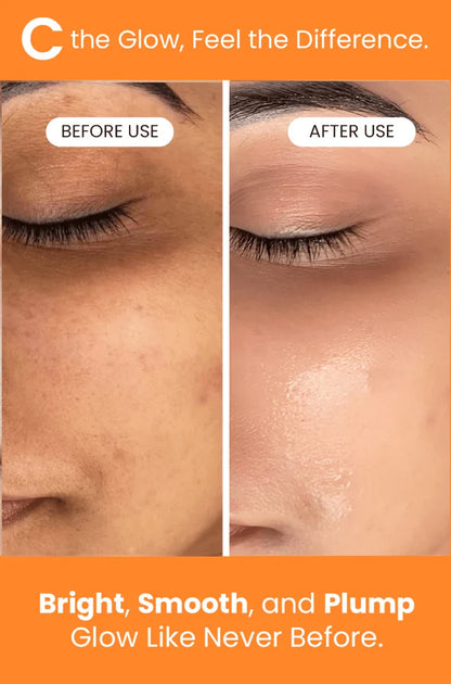 C-Glow Vitamin C Serum