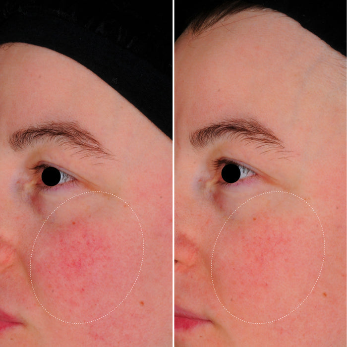 #sku-3770017359930 #seo: capsules skin perfect lightinderm