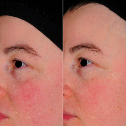 #sku-3770017359930 #seo: capsules skin perfect lightinderm