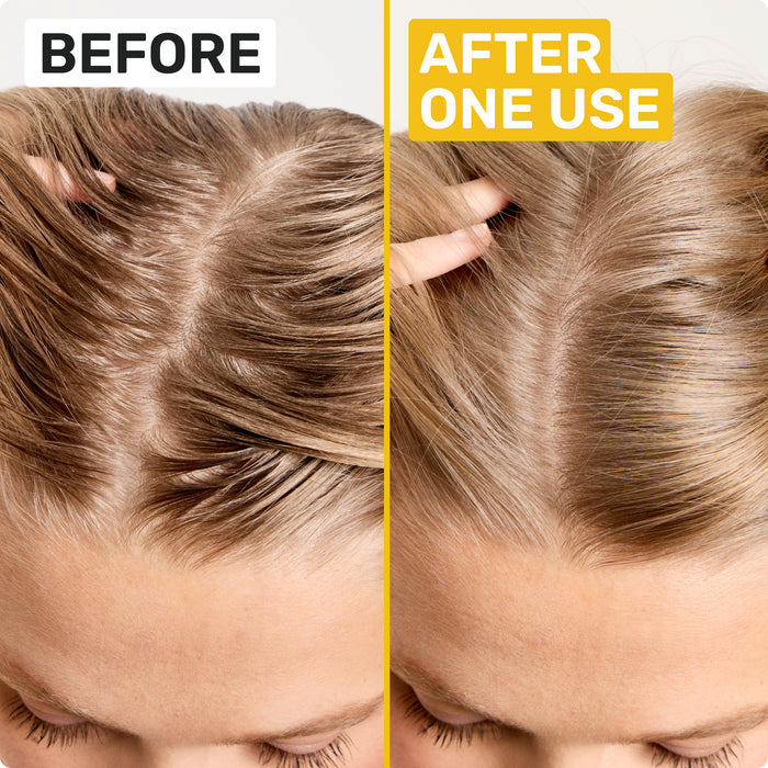 BEFORE
AFTER ONE USE