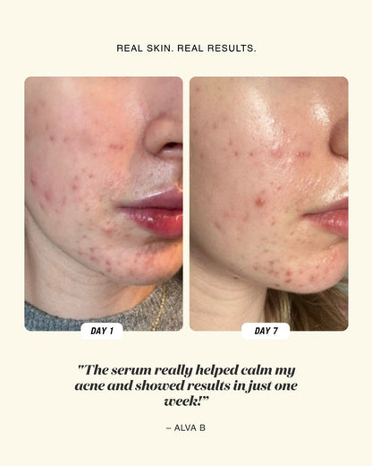 Before and after comparison on a person's face with text about a serum's effectiveness.
