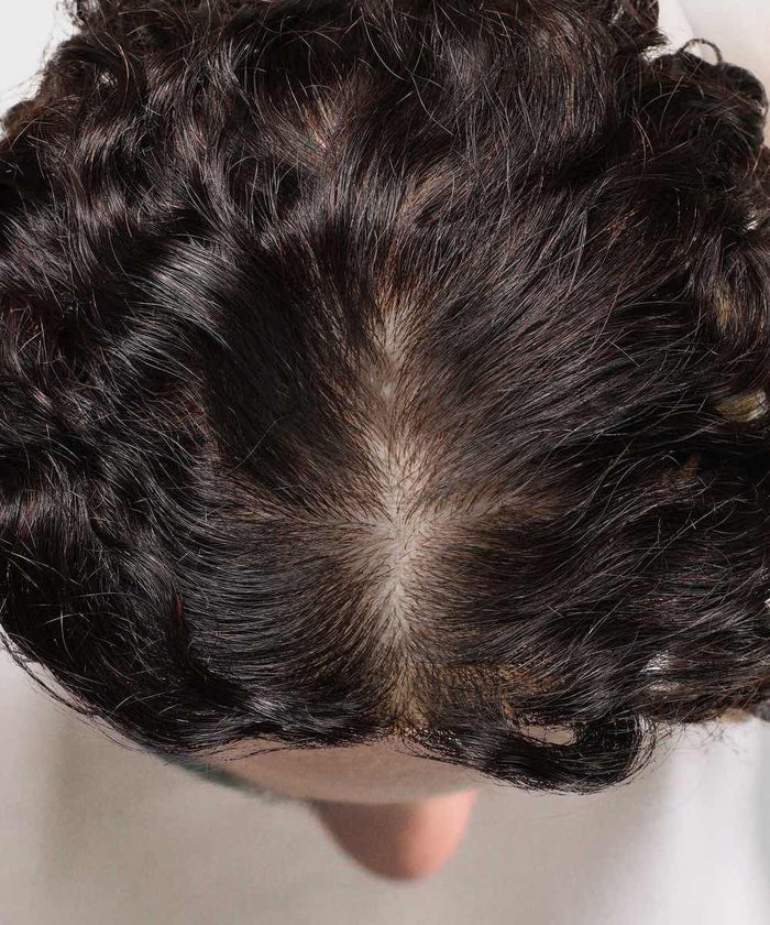 A top view reveals dark, wavy hair parted in the middle, with noticeable thinning and a visible scalp.