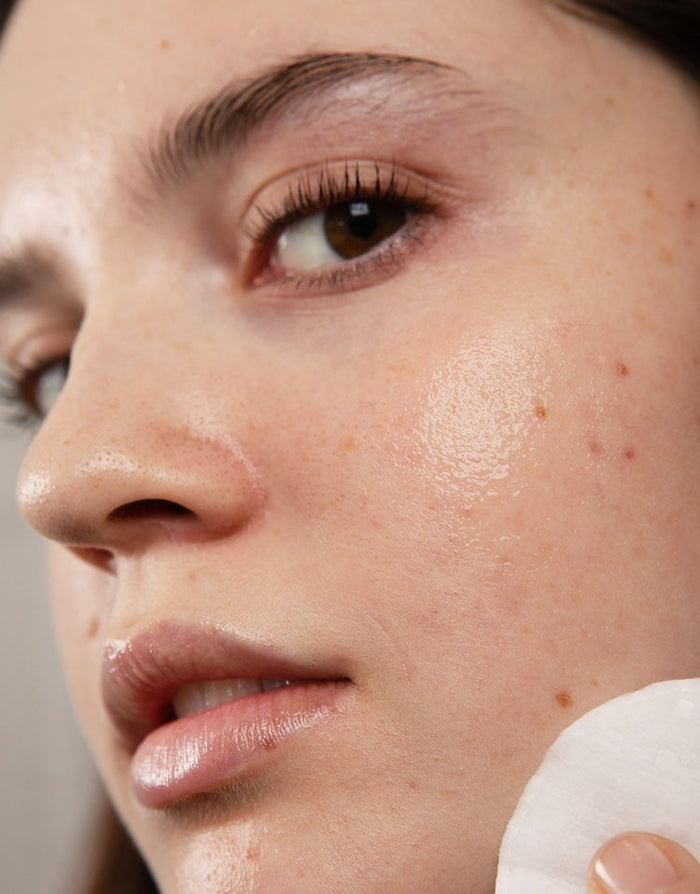 POST-BLEMISH HEROES