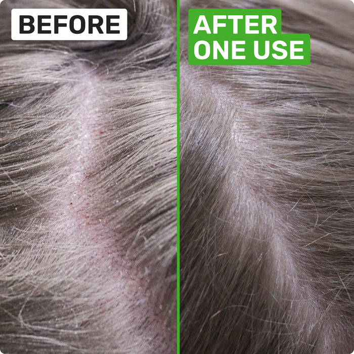 BEFORE
AFTER ONE USE