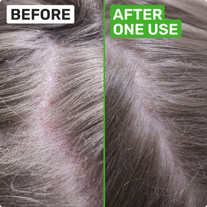 BEFORE
AFTER ONE USE