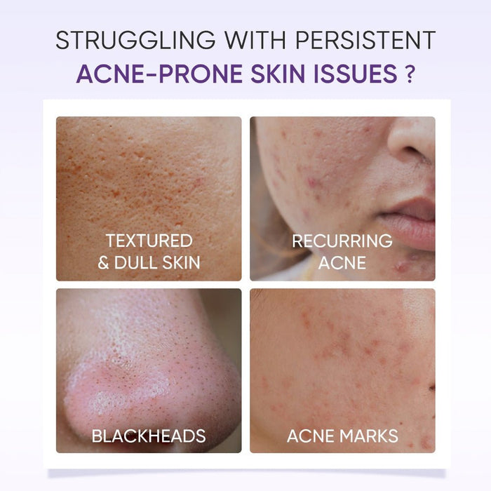 Skintific Lactic Acid Skin Renewal Exfoliating Serum 20ml. مصل تقشير البشرة لتجديد الجلد بحمض اللاكتيك - Princess Cosmetics Qatar