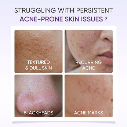 Skintific Lactic Acid Skin Renewal Exfoliating Serum 20ml. مصل تقشير البشرة لتجديد الجلد بحمض اللاكتيك - Princess Cosmetics Qatar