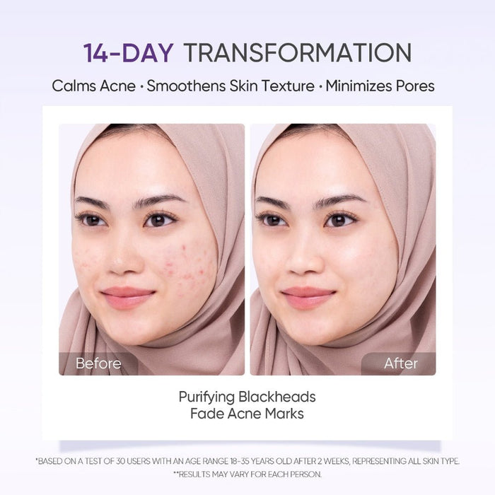 Skintific Lactic Acid Skin Renewal Exfoliating Serum 20ml. مصل تقشير البشرة لتجديد الجلد بحمض اللاكتيك - Princess Cosmetics Qatar