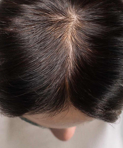 Close-up of thinning natural black hair with a visible scalp along the part line, ideal for showing Perfect Locks Crown Topper coverage.#color_natural-black-(1B)