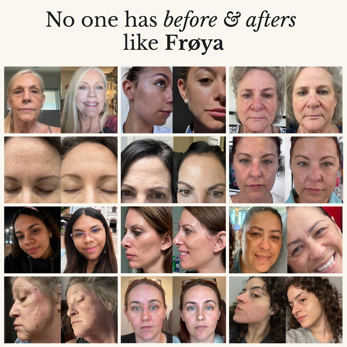 Frøya Organics Complete Mature Skin System — grid of customer before and after results